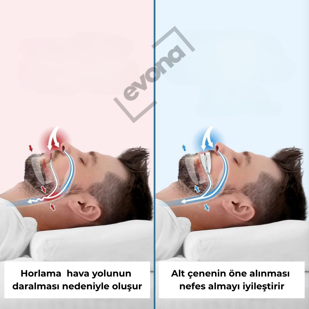 Ayarlanabilir Anti-Horlama Ağızlığı