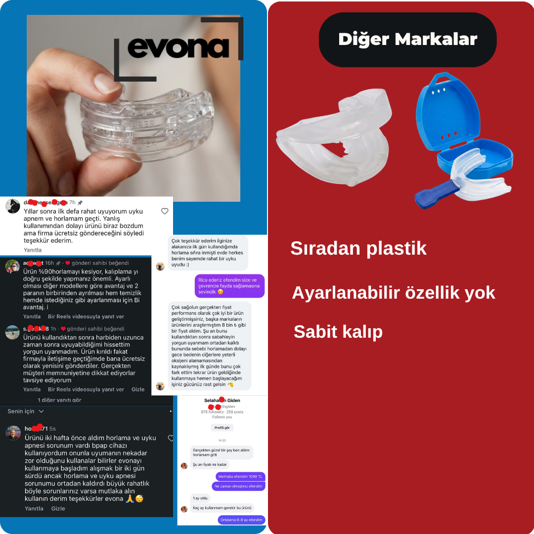Ayarlanabilir Horlama Giderici Ağızlık